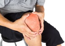 A Comprehensive Guide to Understanding Septic Arthritis