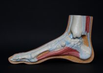 Arthritis of the Foot and Ankle: A Comprehensive Analysis