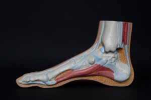 Arthritis of the Foot and Ankle: A Comprehensive Analysis