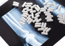 Glucosamine and Chondroitin: Effective Supplements for Arthritis